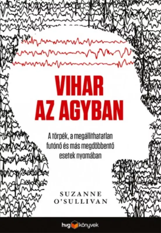 Vihar az agyban - A törpék, a megállíthatatlan futónő és más megdöbbentő esetek nyomában Vásárlói kedvenc