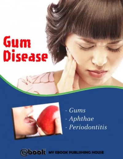 Alacsony ár Gum Disease